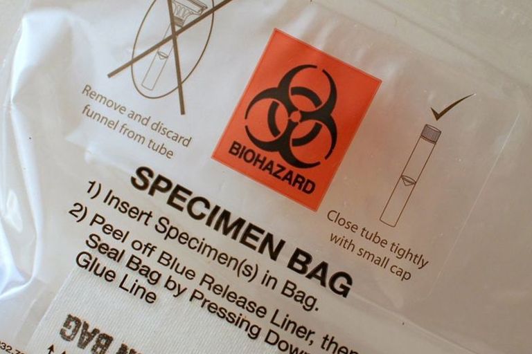Specimen bag for biological sample.