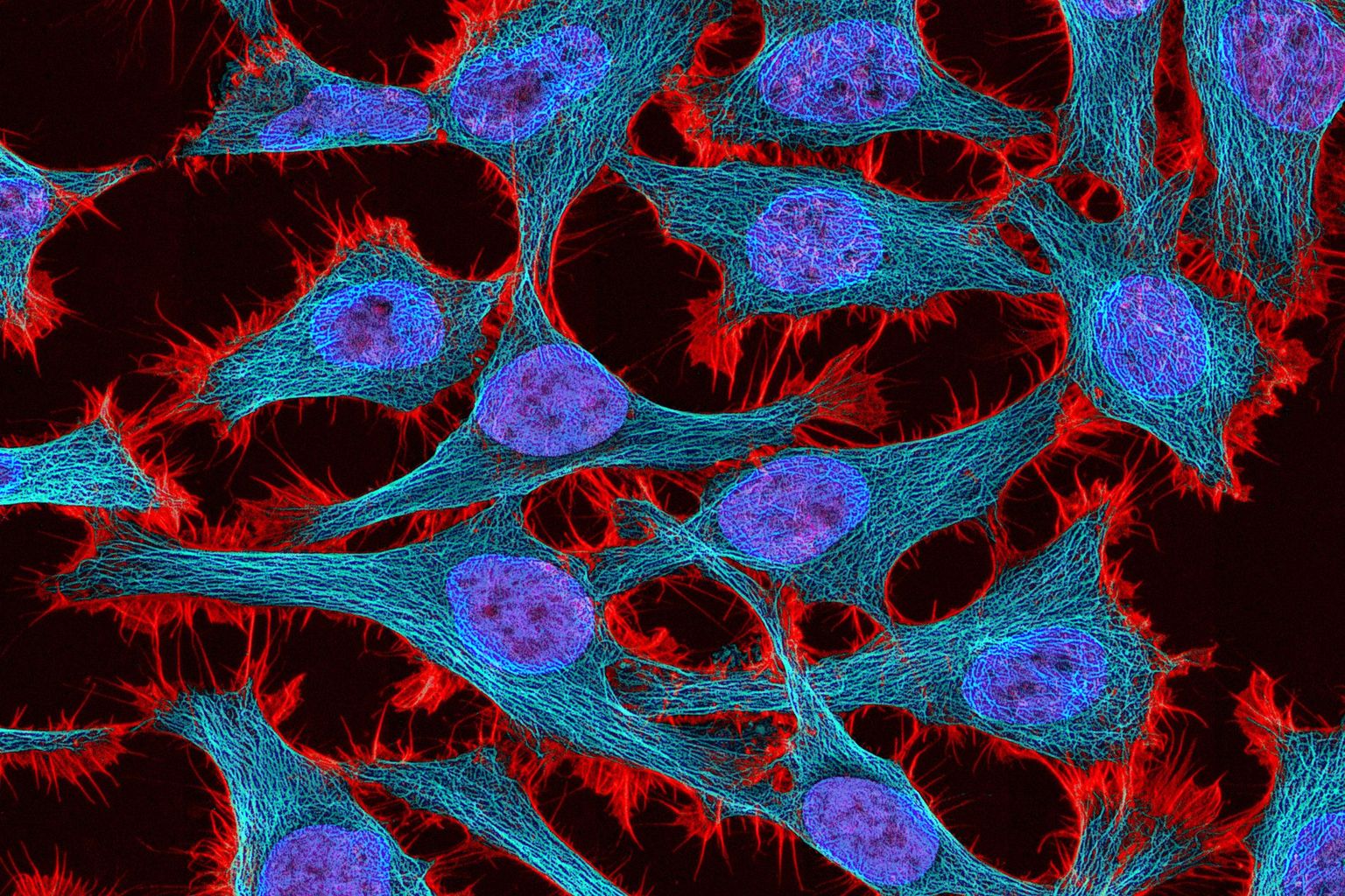 Multiphoton fluorescence image of HeLa cells stained with the actin binding toxin phalloidin (red), microtubules (cyan) and cell nuclei (blue)