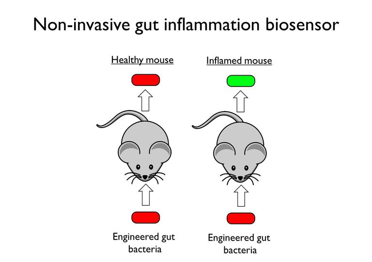 Biosensors for gut inflammation