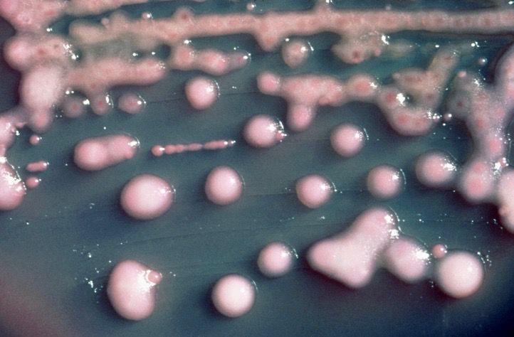 Klebsiella pneumonae colony growing on an agar plate