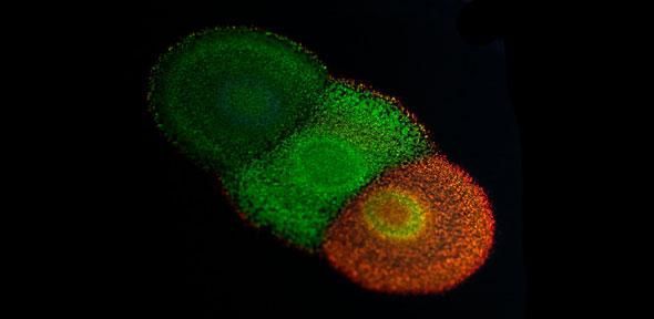 Colony of the Flavobacterium IR1 (Credit: Dr Colin Ingham, Hoekmine BV)
